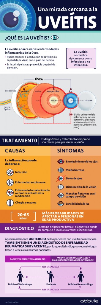 infografia-uveitis