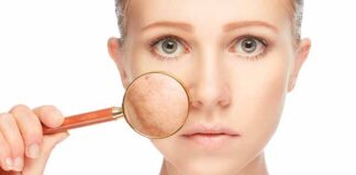 consecuencias del estrés en la piel