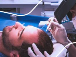 injerto capilar Kaloni