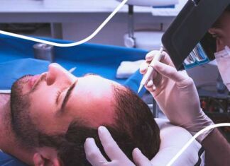 injerto capilar Kaloni