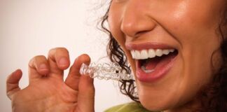 crecimiento alineadores invisibles