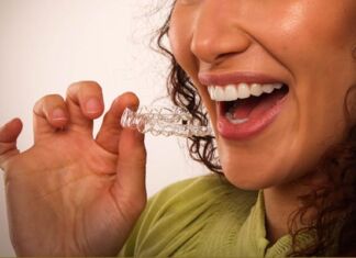 crecimiento alineadores invisibles