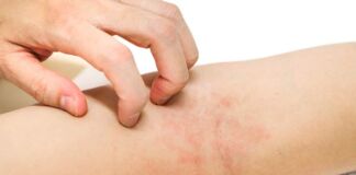 afecciones de la piel por diabetes