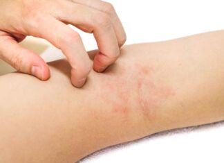 afecciones de la piel por diabetes