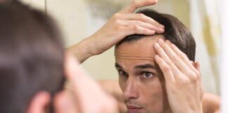 diagnóstico de alopecia