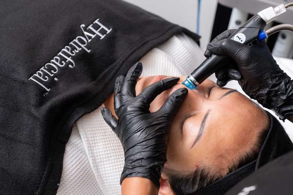 hydrafacial-syndeo Hydrafacial Syndeo para la piel