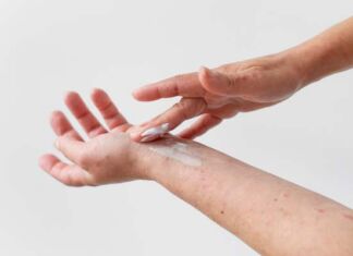 tratamiento de heridas con ácido hialurónico