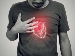 claves para prevenir arritmias
