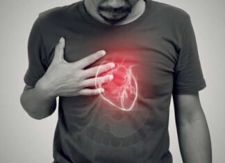 claves para prevenir arritmias