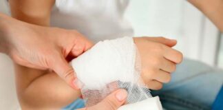 accidentes por quemaduras en fiestas decembrinas